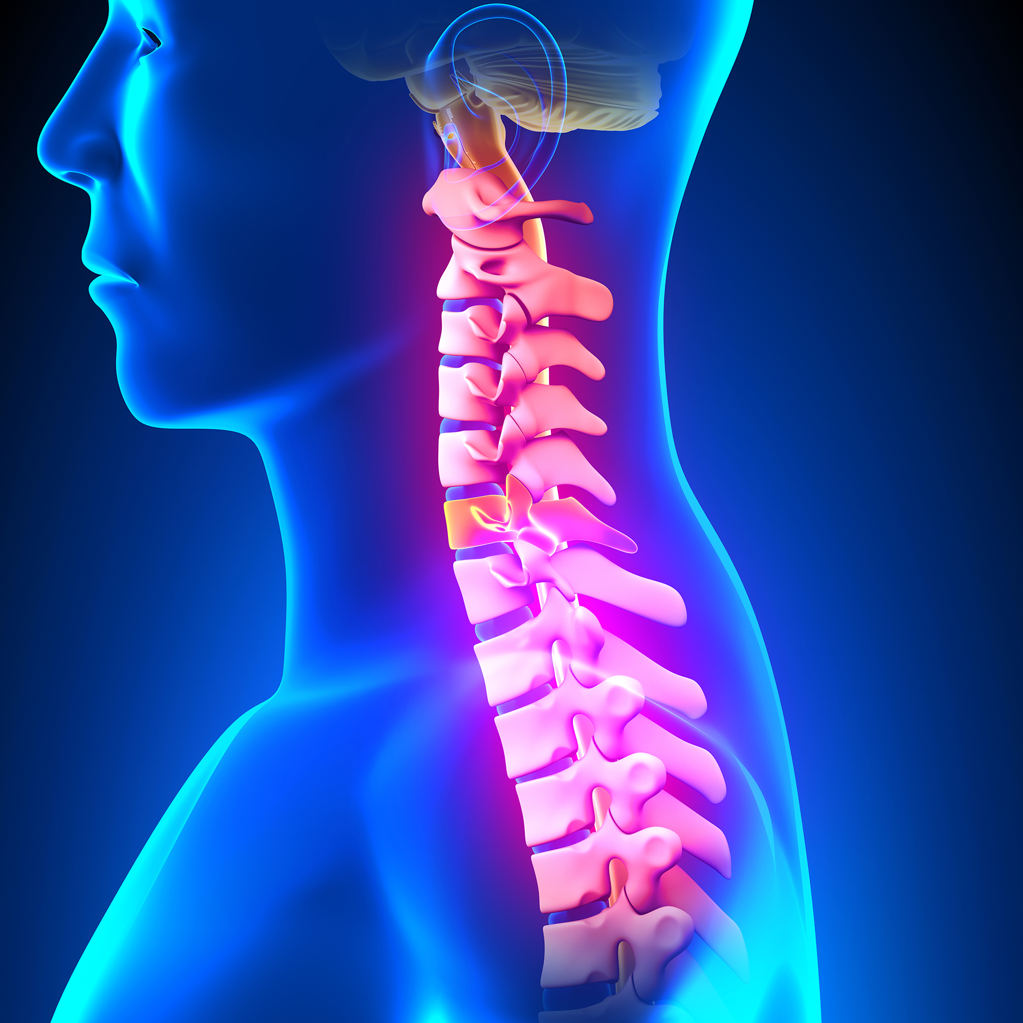 Neck Pain caused by Auto Accident